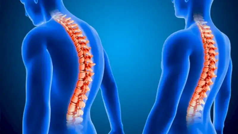 Degenerative Disc Disease: Causes, Symptoms and Treatment Methods