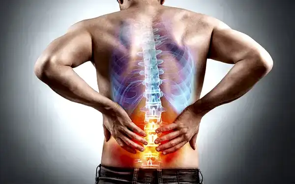 Bel Fıtığı Tedavisi Nasıl Yapılır?